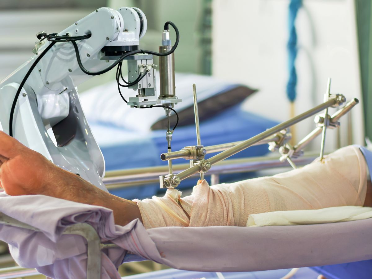 Robotic Total Knee Replacement