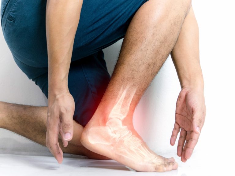 Understanding the Different Types of Foot and Ankle Arthritis