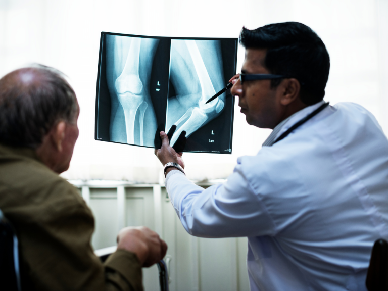 Myths and Facts About Total Knee Replacement (TKR)