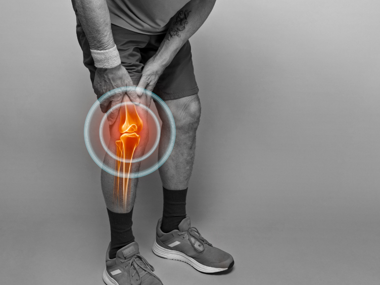 Knee Joint Instability Explained: Causes, Symptoms, Diagnosis, Risks & Recovery Options
