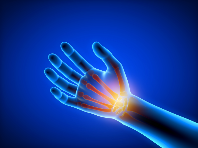 Comprehensive Guide to Wrist Surgery: Types, Procedures, and Recovery