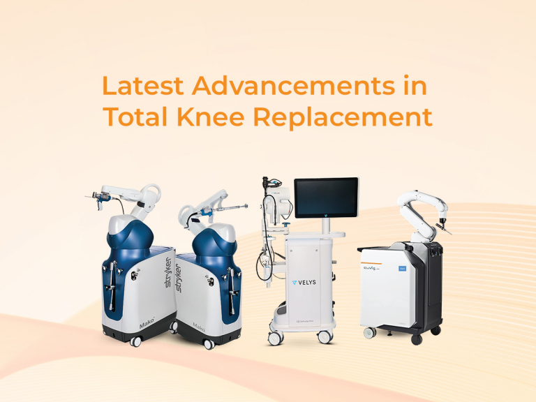Latest Advancements in Total Knee Replacement 