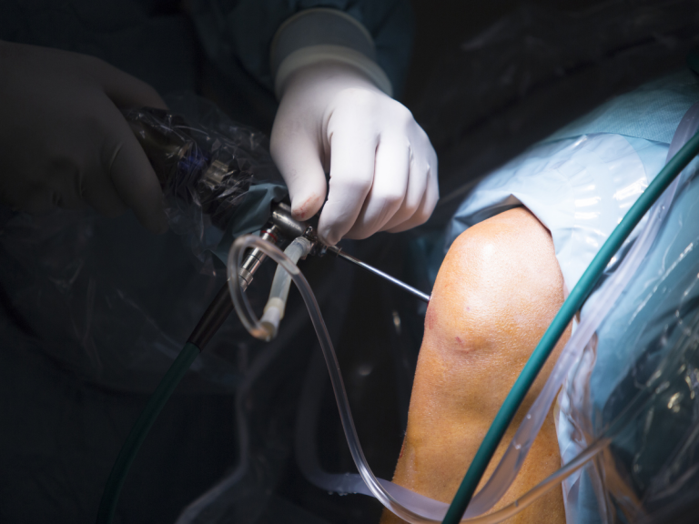  Surgical Treatments for Osteoarthritis