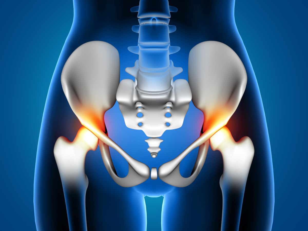 Total Hip Replacement Surgery