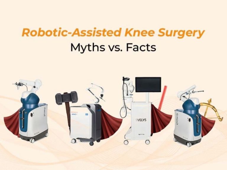 Robotic-Assisted Knee Surgery: Myths vs. Facts